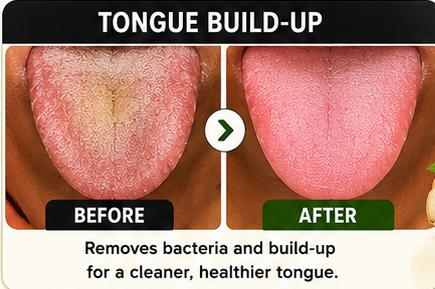 Tongue Build-up Before and After